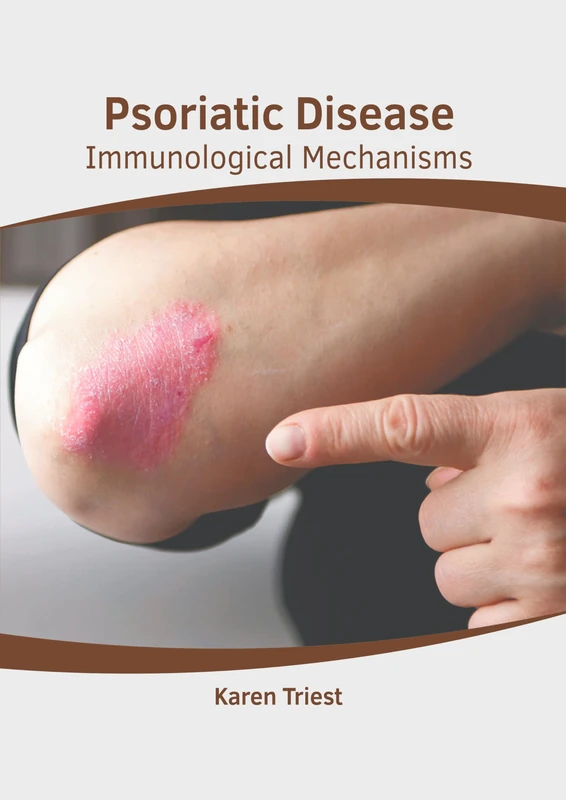 Psoriatic Disease: Immunological Mechanisms
