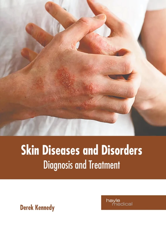 Skin Diseases and Disorders: Diagnosis and Treatment