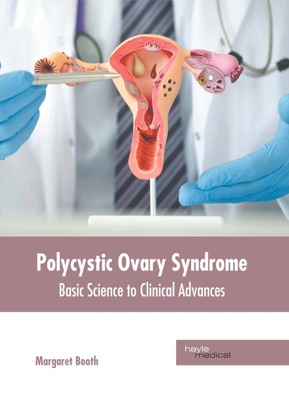 Polycystic Ovary Syndrome: Basic Science to Clinical Advances
