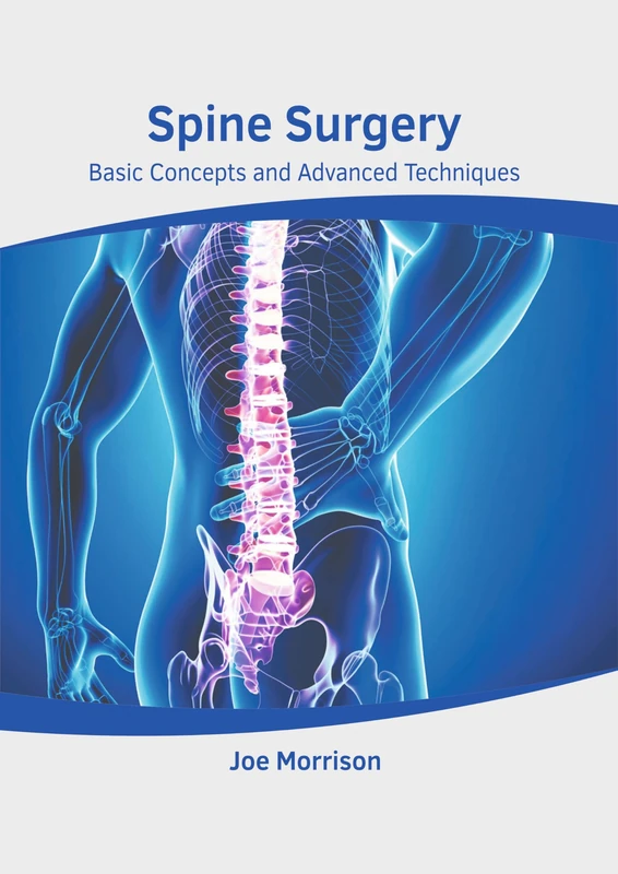 Spine Surgery: Basic Concepts and Advanced Techniques