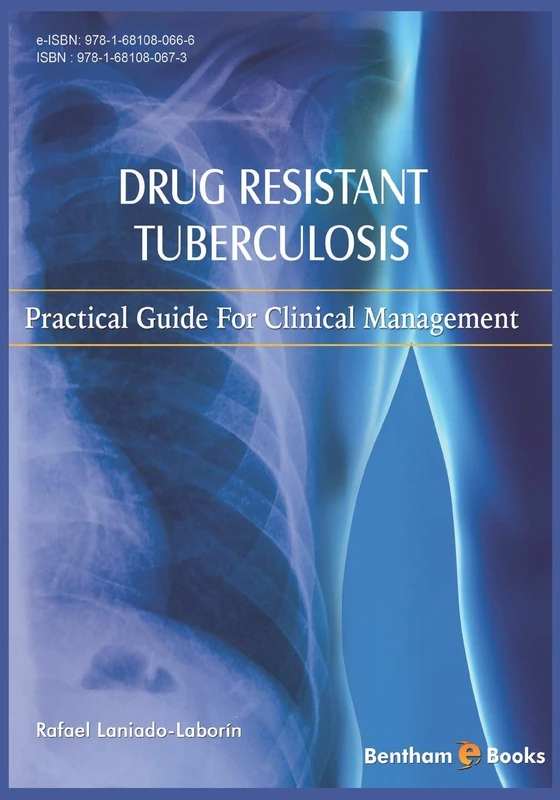 Drug Resistant Tuberculosis: Practical guide for clinical management