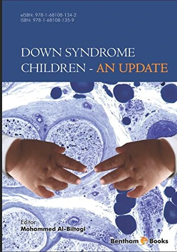 Down Syndrome Children - an Update