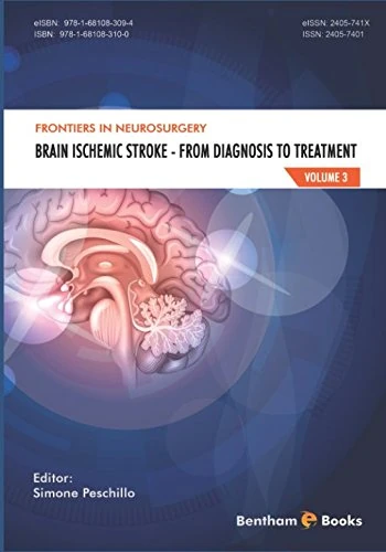 Brain Ischemic Stroke: Brain Ischemic Stroke - From Diagnosis to Treatment (Frontiers in Neurosurgery)