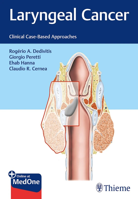 Laryngeal Cancer: Clinical Case-Based Approaches