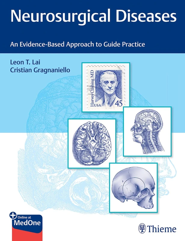 Neurosurgical Diseases: An Evidence-Based Approach to Guide Practice