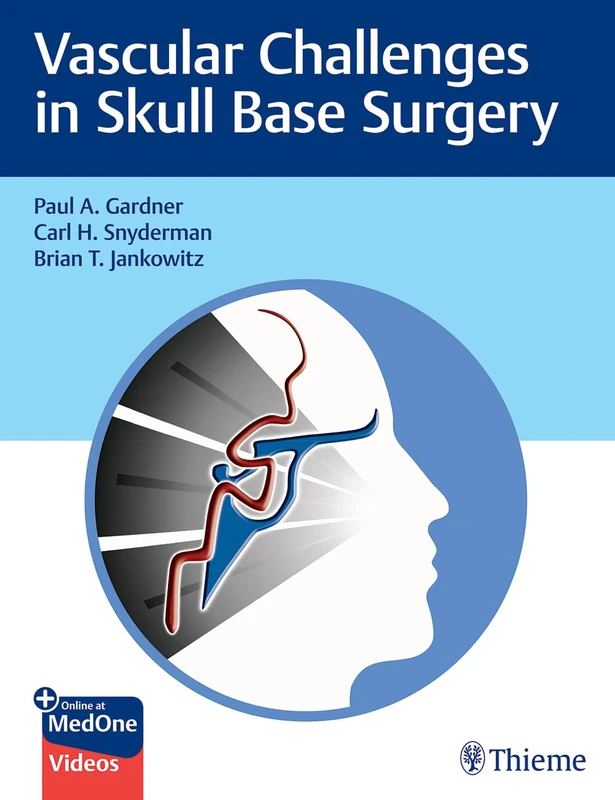 Thieme Vascular Challenges in Skull Base Surgery Guide
