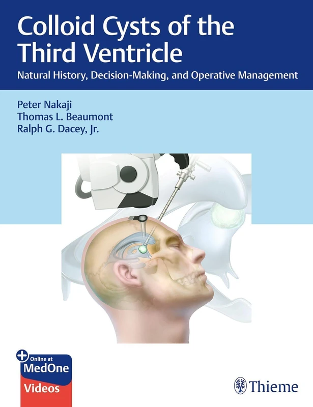 Thieme Colloid Cysts of the Third Ventricle Medical Book