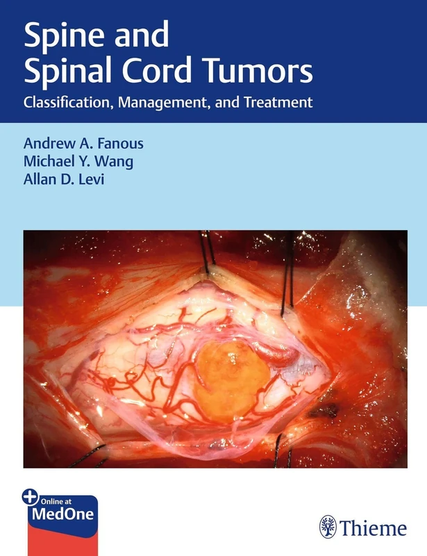 Spine and Spinal Cord Tumors: Classification, Management, and Treatment