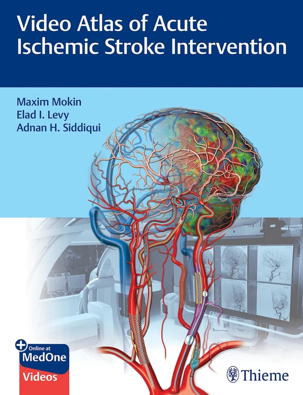 Thieme Video Atlas of Acute Ischemic Stroke Intervention