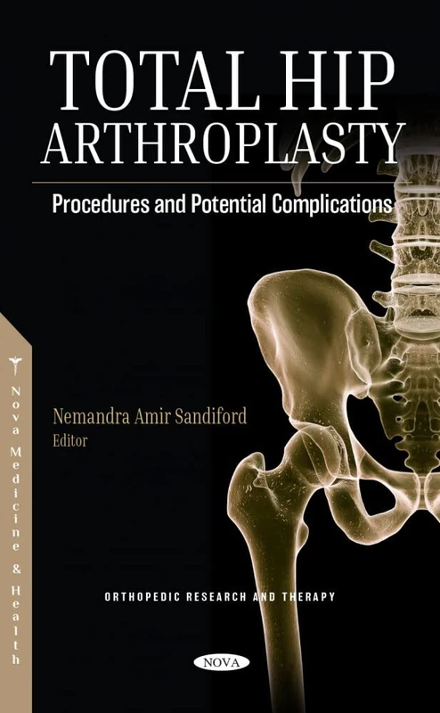 Total Hip Arthroplasty: Procedures and Potential Complications (Orthopedic Research and Therapy)
