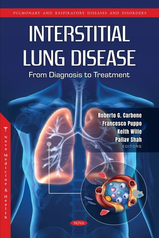 Interstitial Lung Disease: From Diagnosis to Treatment (Pulmonary and Respiratory Diseases and Disorders) - Image 1