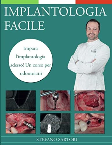 IMPLANTOLOGIA FACILE: Impara l'implantologia adesso! Un corso per odontoiatri.