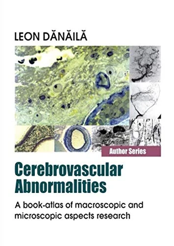 Cerebrovascular Abnormalities: A Book-Atlas of Macroscopic and Microscopic Aspects Research
