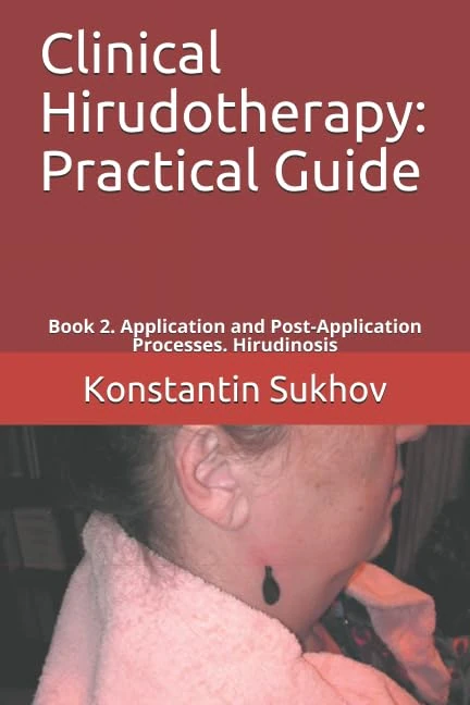Clinical Hirudotherapy: Practical Guide: Book 2. Application and Post-Application Processes. Hirudinosis - Image 1