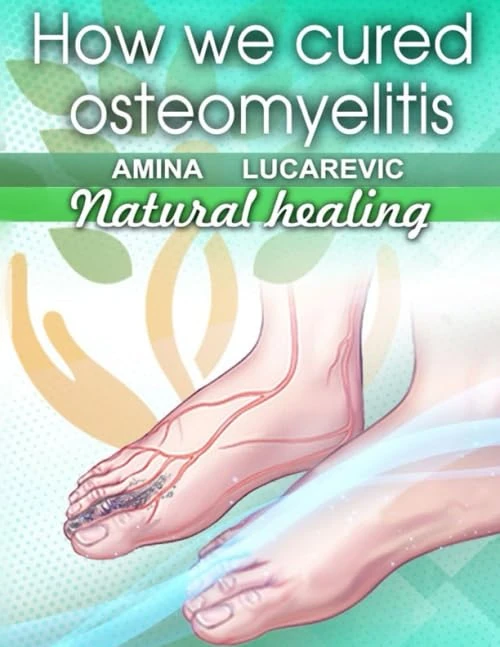 HOW WE CURED OSTEOMYELITIS - Image 1