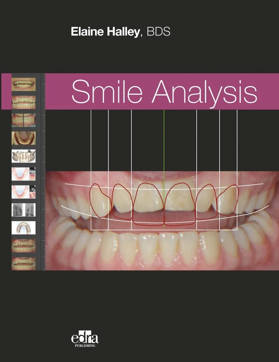 Smile Analysis