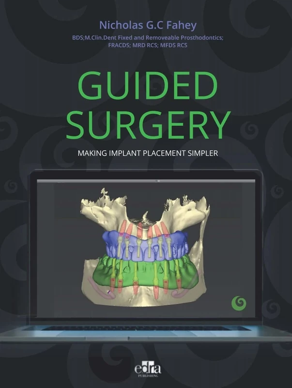 Guided Surgery