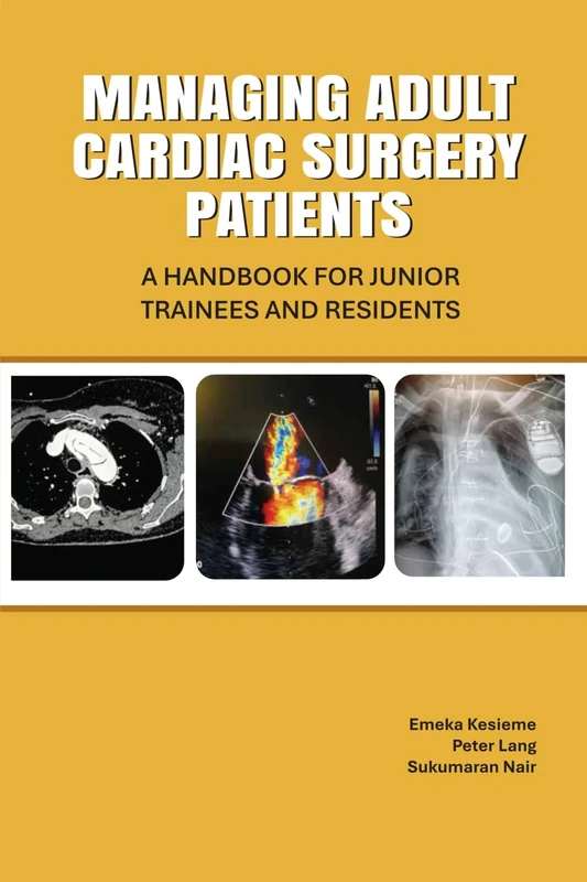 MANAGING ADULT CARDIAC SURGERY PATIENTS: A HANDBOOK FOR JUNIOR TRAINEES AND RESIDENTS