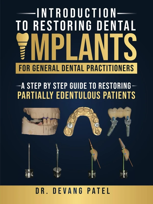 Introduction to Restoring Dental Implants for General Dental Practitioners: A Step by Step Guide to Restoring Partially Edentulous Patients