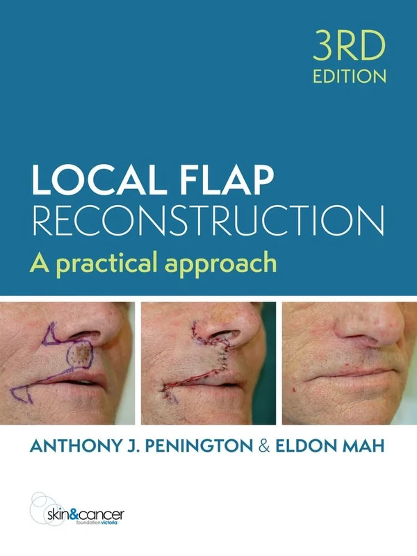 Local Flap Reconstruction, 3rd Edition