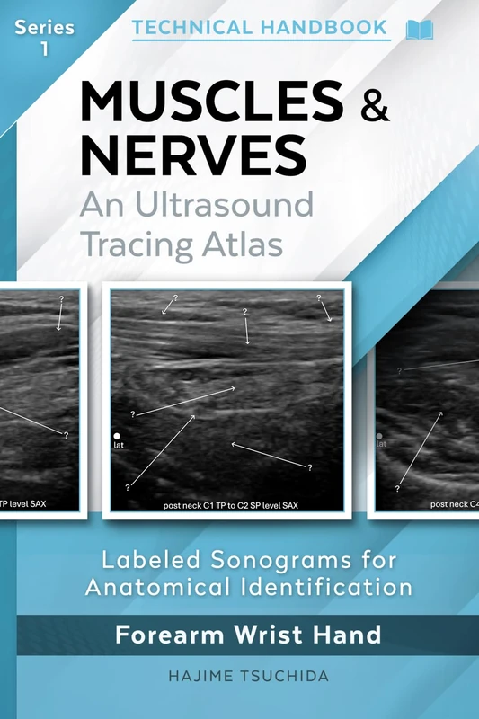 TECHNICAL ULTRASOUND HANDBOOK - MUSCLES & NERVES: An Ultrasound Tracing Atlas (Series 1)