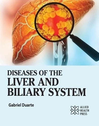 Diseases of the Liver and Biliary System - Delve Publishing