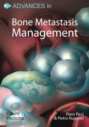 Advances in Bone Metastasis Management