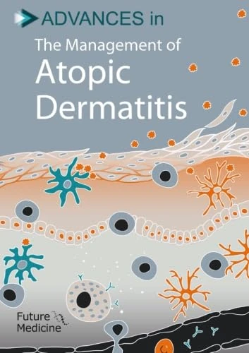 Advances in the Management of Atopic Dermatitis