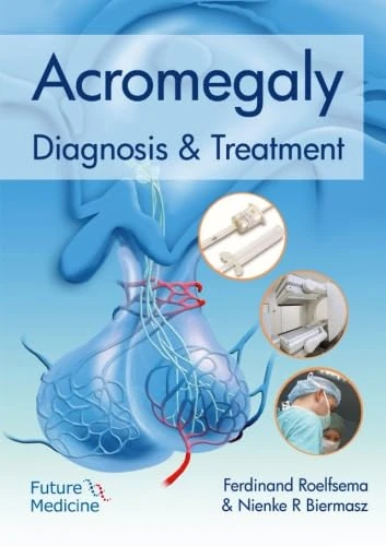 Acromegaly: Diagnosis and Treatment