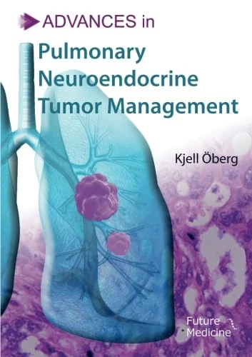 Advances in Pulmonary Neuroendocrine Tumor Management