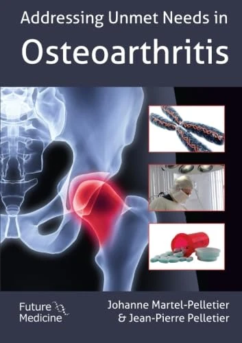 Addressing Unmet Needs in Osteoarthritis