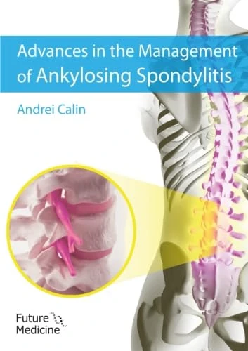 Advances in the Management of Ankylosing Spondylitis