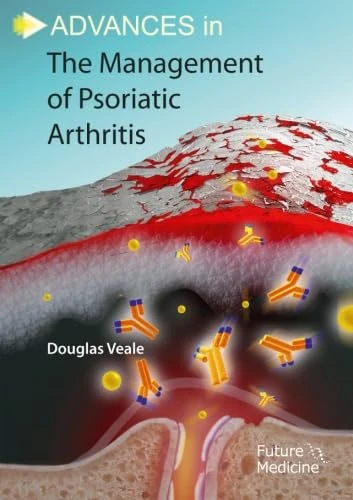 Advances in the Management of Psoriatic Arthritis
