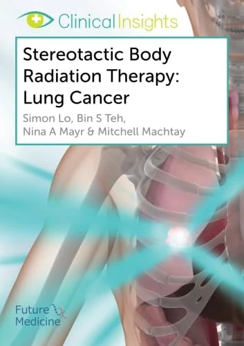 Clinical Insights: Stereotactic Body Radiation Therapy: Lung Cancer