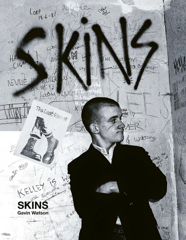 Skins: Gavin Watson (ACC Collector’s Editions)
