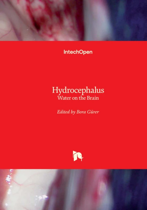 Hydrocephalus - Water on the Brain - Image 1