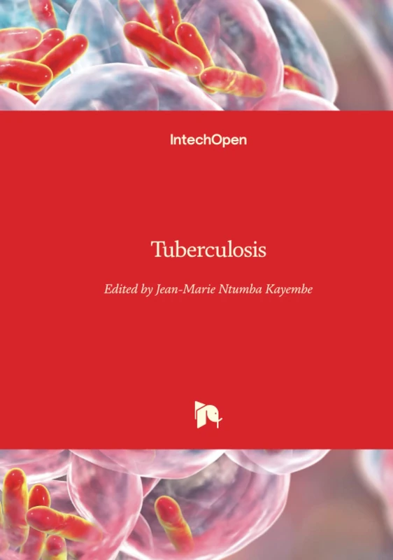 Tuberculosis