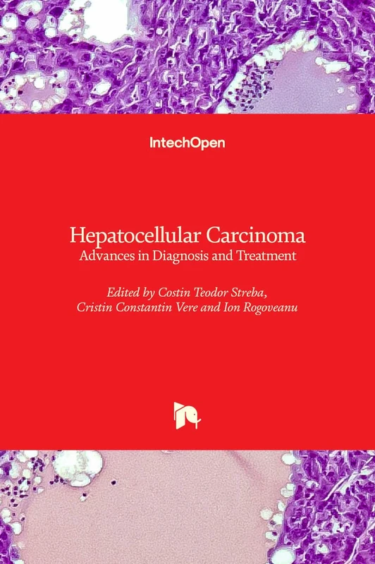 Hepatocellular Carcinoma - Advances in Diagnosis and Treatment