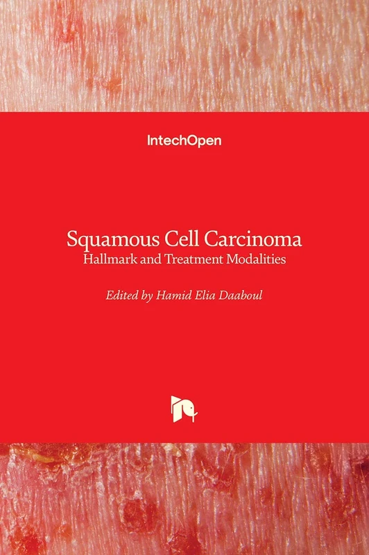 Squamous Cell Carcinoma: Hallmark and Treatment Modalities