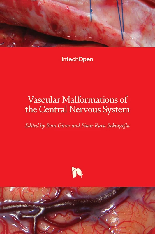 Vascular Malformations of the Central Nervous System - Image 1