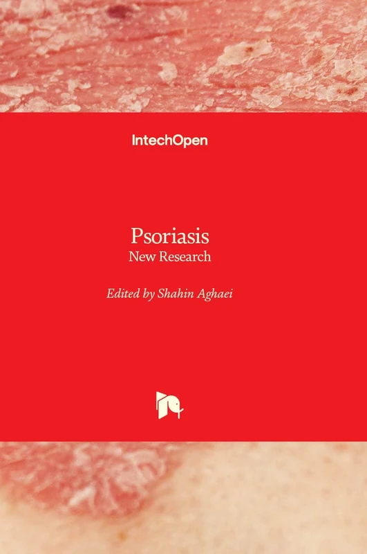 Psoriasis - New Research - Image 1