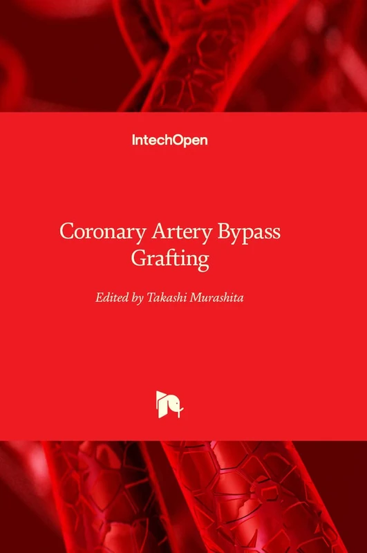 Coronary Artery Bypass Grafting