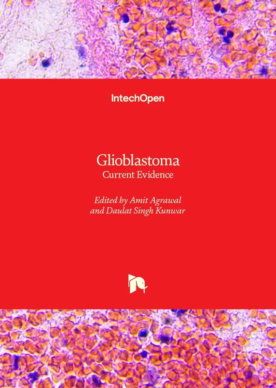 Glioblastoma: Current Evidence