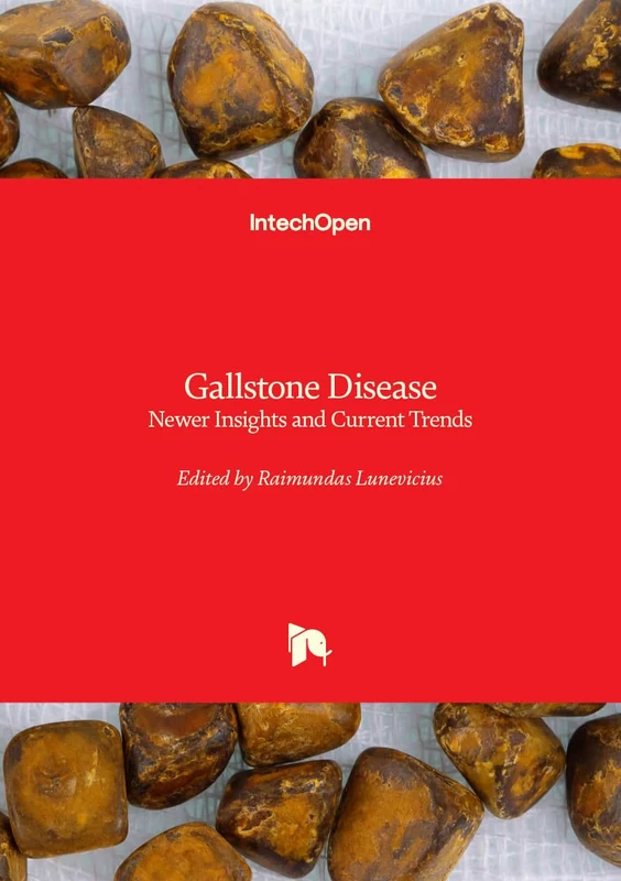 Gallstone Disease - Newer Insights and Current Trends