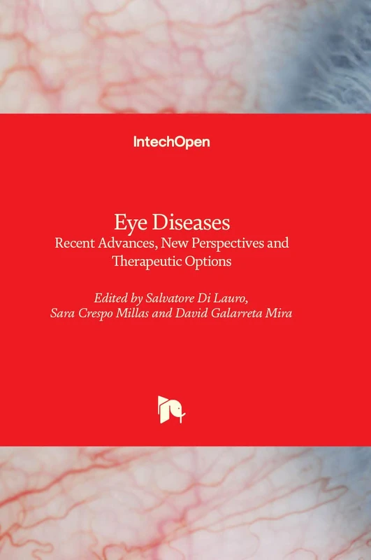 Eye Diseases - Recent Advances, New Perspectives and Therapeutic Options