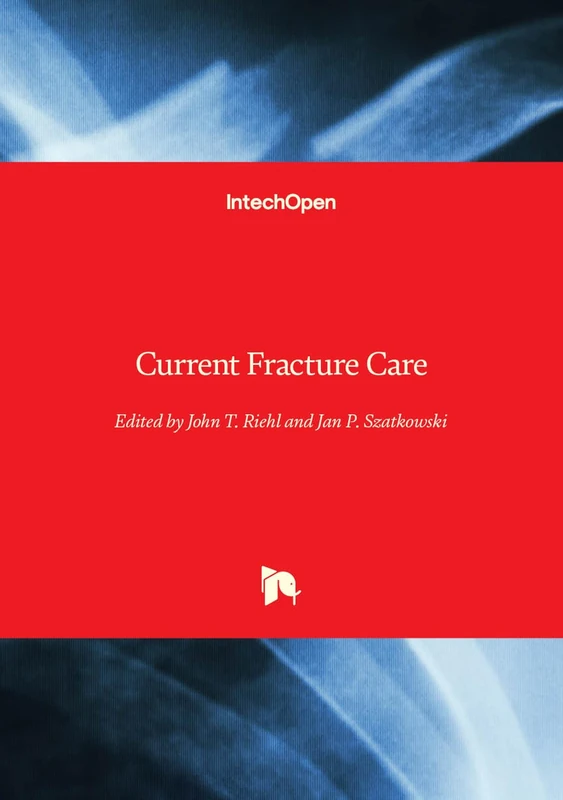 Current Fracture Care