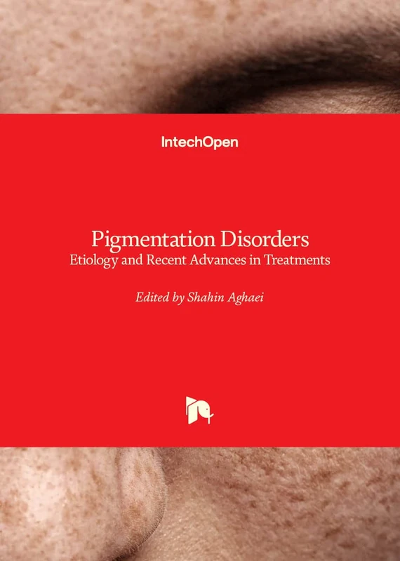 Pigmentation Disorders - Etiology and Recent Advances in Treatments - Image 1