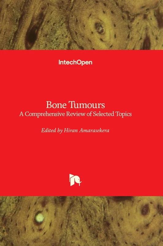 Bone Tumours - A Comprehensive Review of Selected Topics - Image 1
