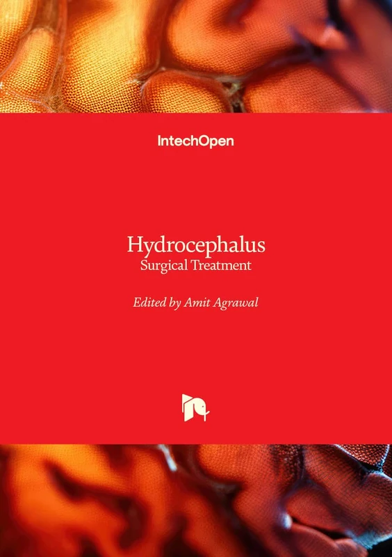 Hydrocephalus - Surgical Treatment