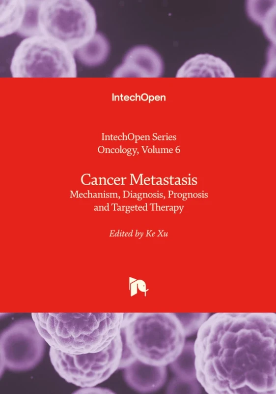 Cancer Metastasis - Mechanism, Diagnosis, Prognosis and Targeted Therapy (Oncology)